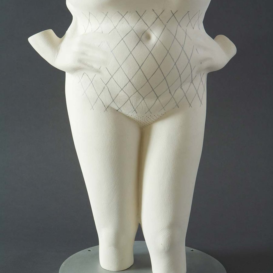 Claudia Fitch, Net